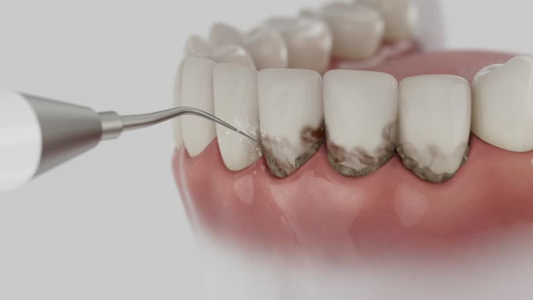 Trusted Teeth Cleaning And Checkup service in Lemoyne, PA - Dentist Open Now
